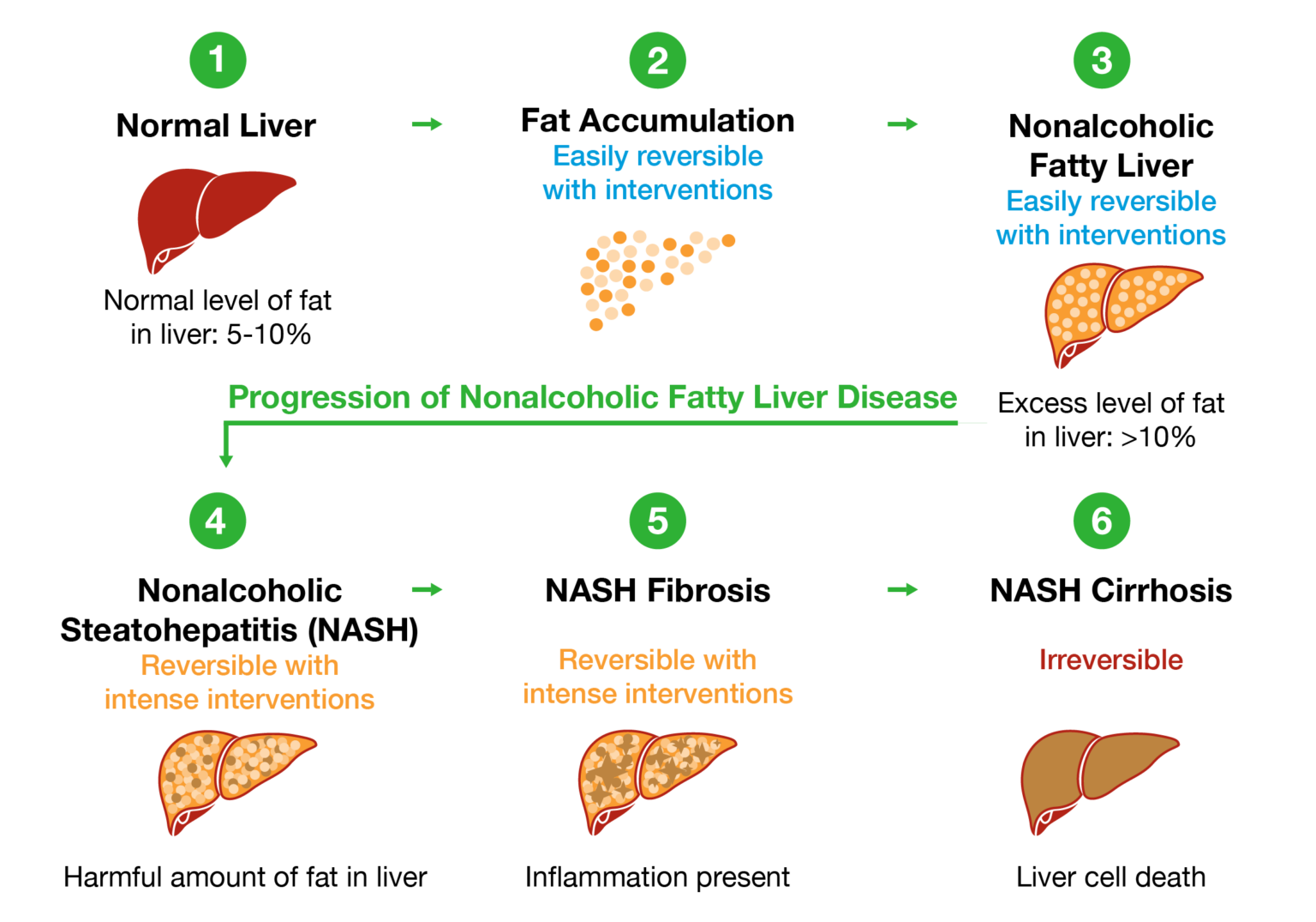 here-s-how-nonalcoholic-fatty-liver-disease-can-lead-to-liver-failure